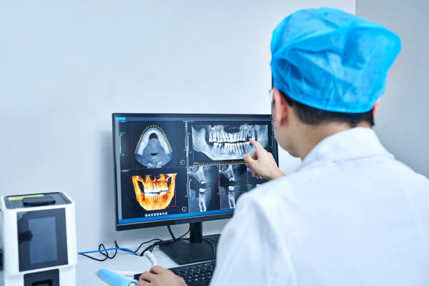 Best Emergency Wisdom Tooth Extraction in Birch Run, MI