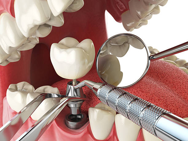 Best Emergency Treatment for Jaw Pain or Injury in Birch Run, MI